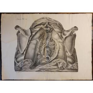 Black And White Engraving Anatomical Pathology Atlante Generale By Jean Cruveilhier 1839