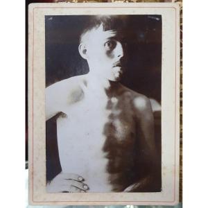 Curiosity: Three Medical Photographs Of A Clinical Case Of Dislocation Following An Accident