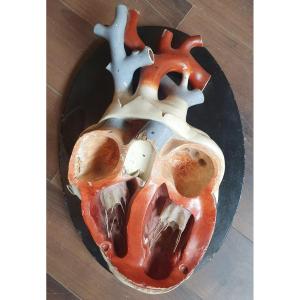 Objet De Curiosité : Anatomy: Bock Steger Plaster Heart 