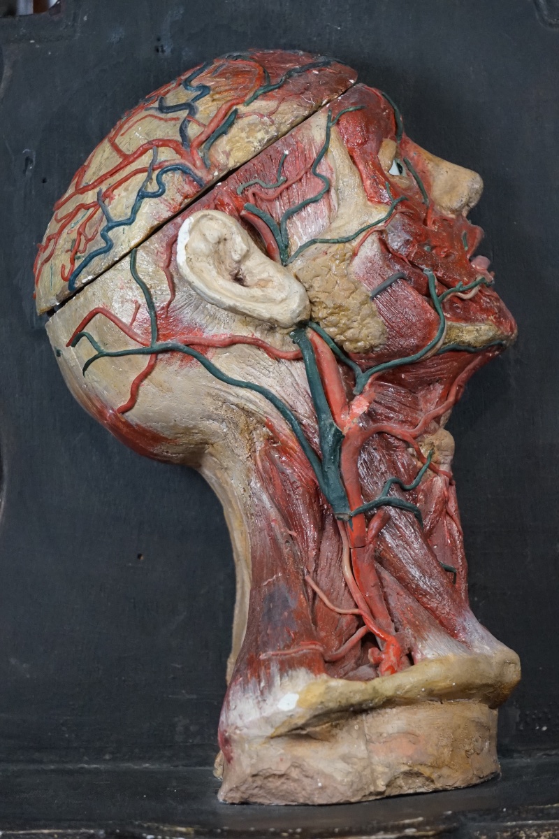 Rara Testa Anatomica di "Scorticato" (Écorché) in Stucco e Cera-photo-2