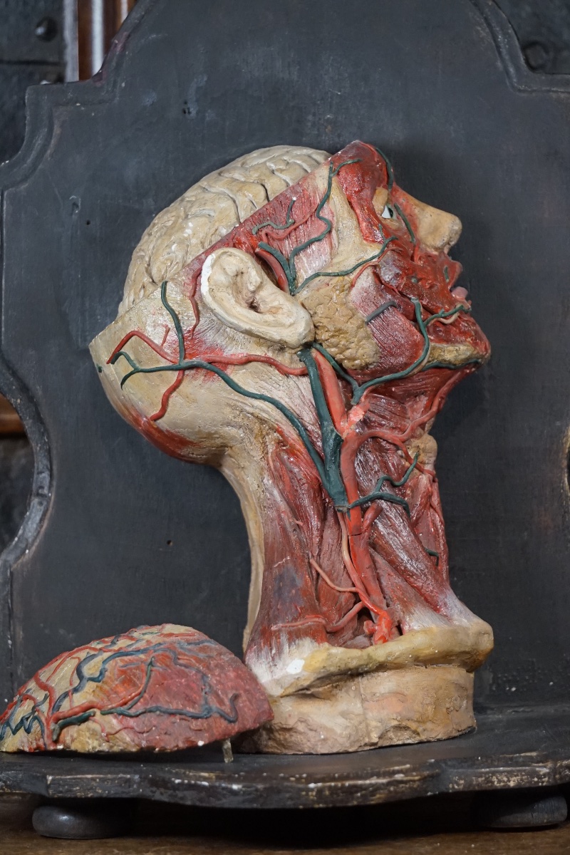 Rara Testa Anatomica di "Scorticato" (Écorché) in Stucco e Cera-photo-3