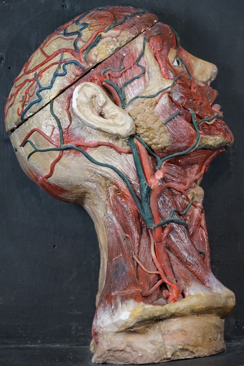 Rara Testa Anatomica di "Scorticato" (Écorché) in Stucco e Cera-photo-2