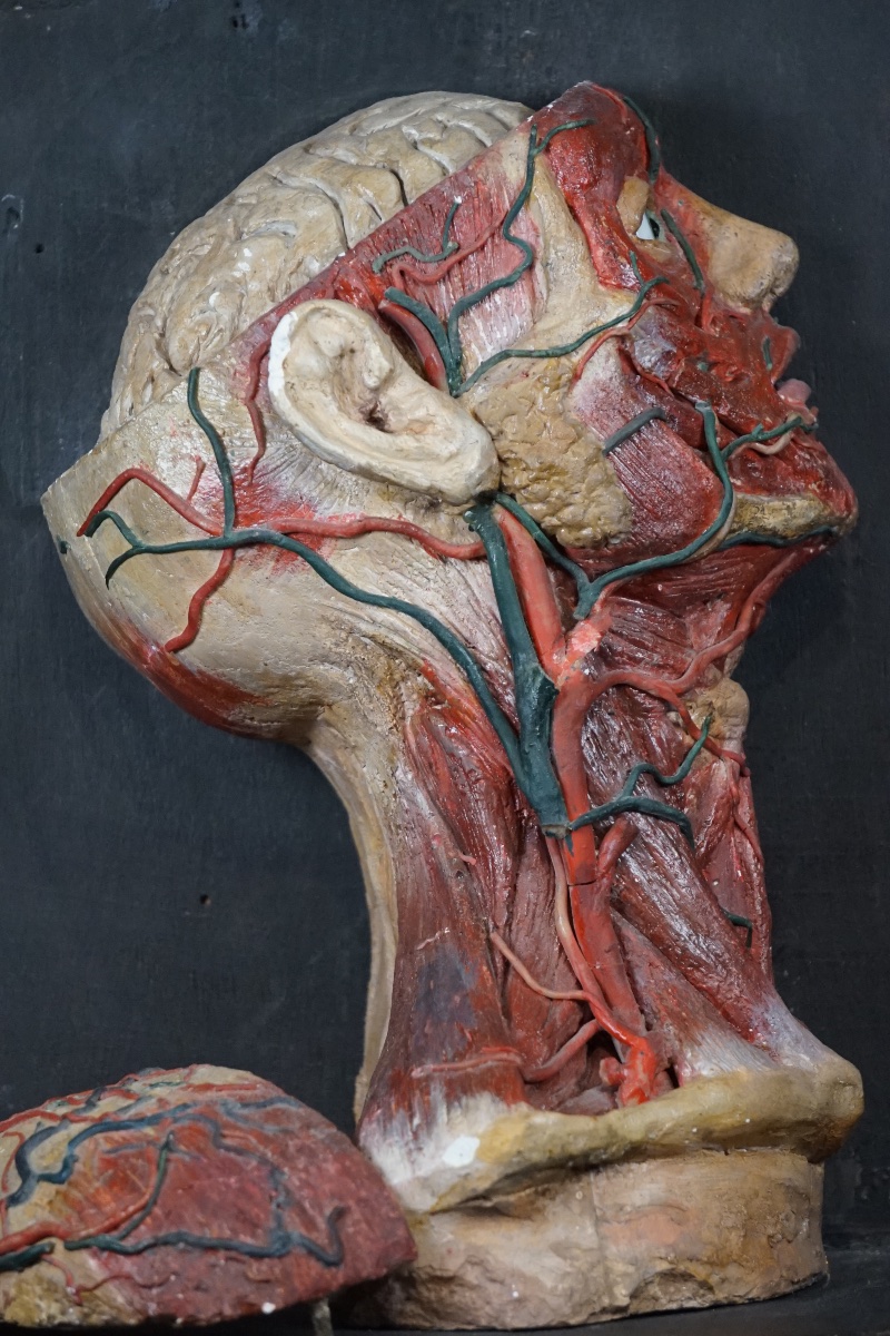Rara Testa Anatomica di "Scorticato" (Écorché) in Stucco e Cera-photo-3
