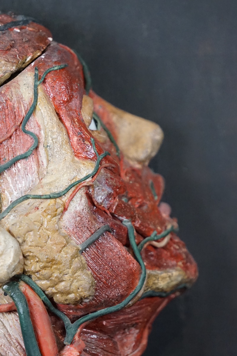 Rara Testa Anatomica di "Scorticato" (Écorché) in Stucco e Cera-photo-8