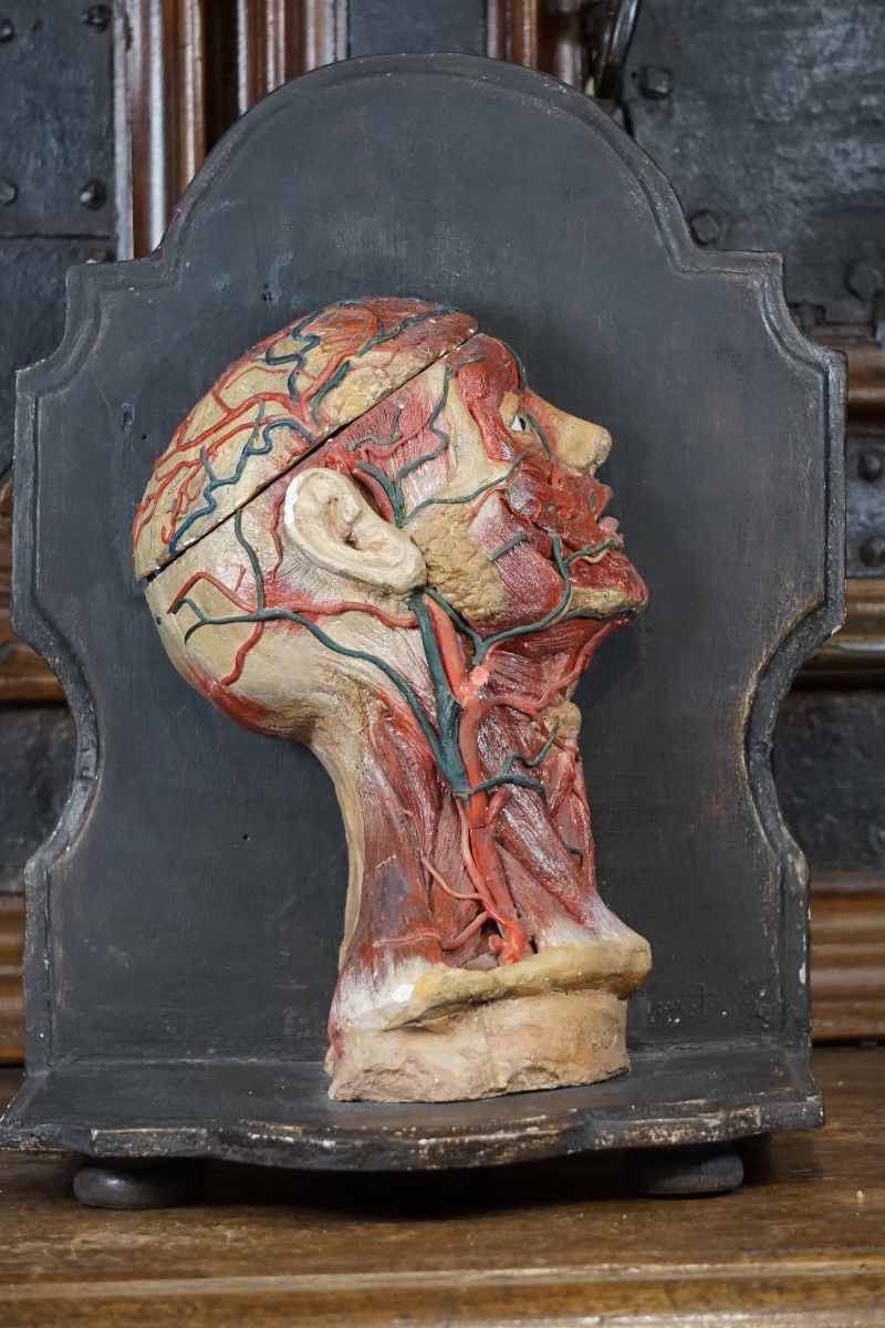 Rara Testa Anatomica di "Scorticato" (Écorché) in Stucco e Cera