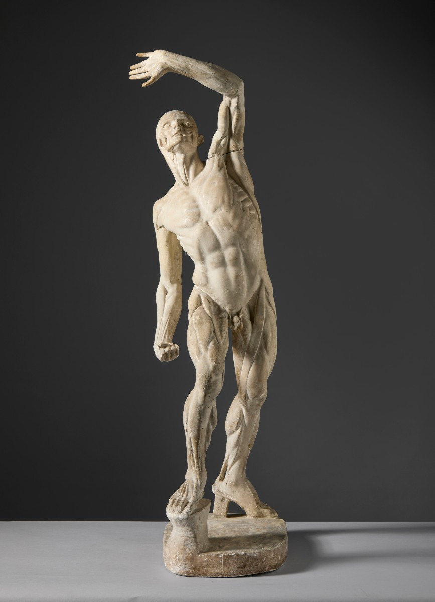Da Jacques - Eugène Caudron ( 1818-1865) -  “Ecorchè” Scorticato con braccio alzato-photo-2