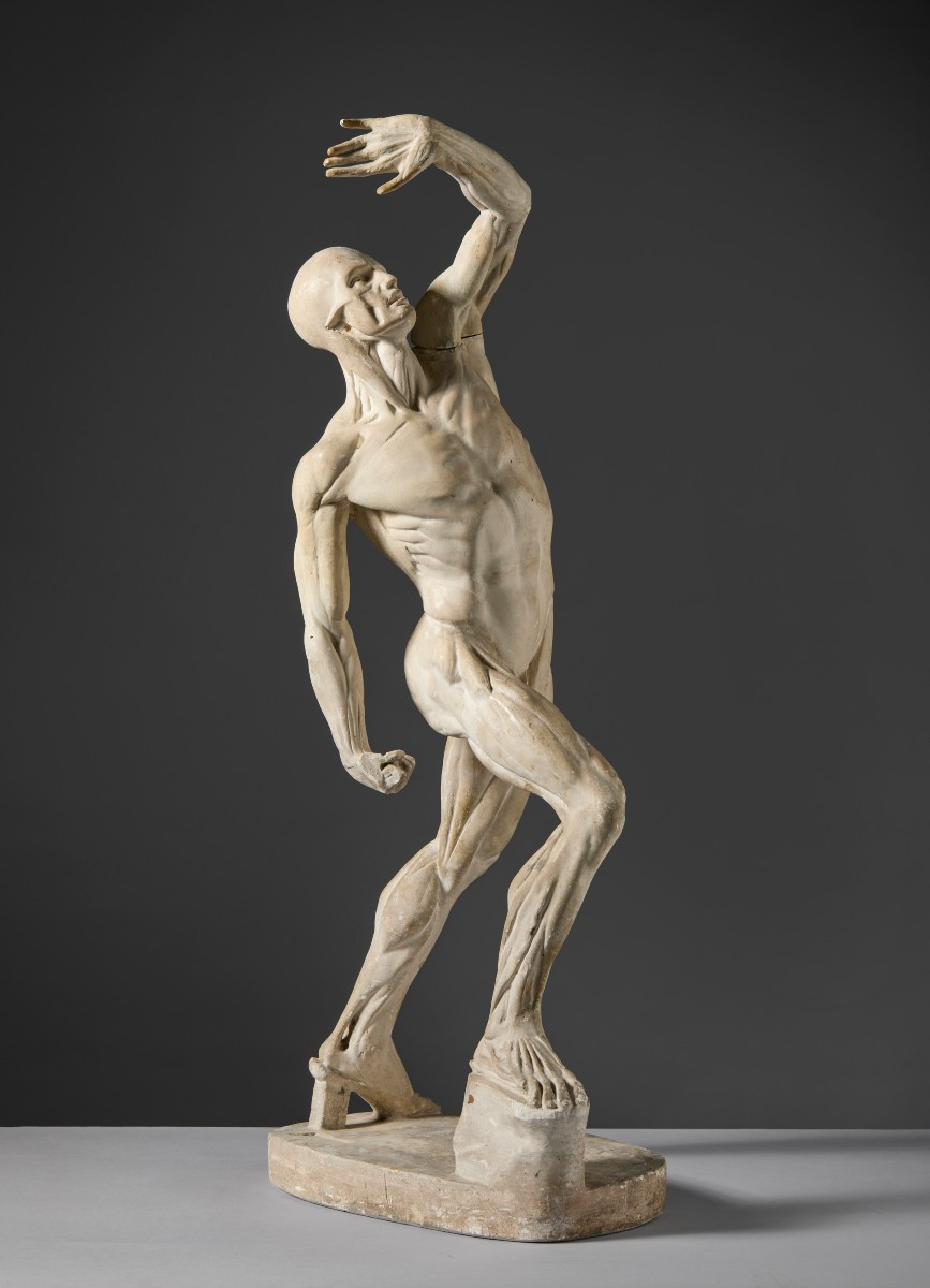 Da Jacques - Eugène Caudron ( 1818-1865) -  “Ecorchè” Scorticato con braccio alzato