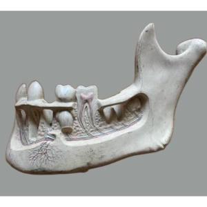 Skinned Dental Mandible In Painted Plaster XIX