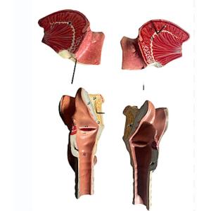 Flayed Larynx Otho Rhino Removable Painted Plaster Auzoux Type C: 1880