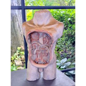 “skinned” Anatomical Bust In Terracotta - 19th Century