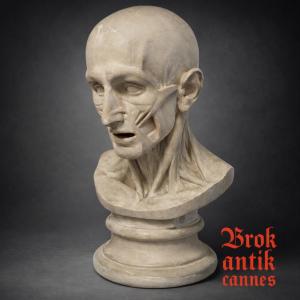 Flayed Bust - Plaster - Houdon - France - XIX Th