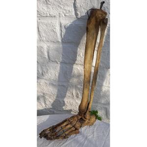 Bone Foot And Foot Bones