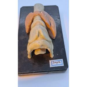 An Anatomical Larynx From The 19th Century