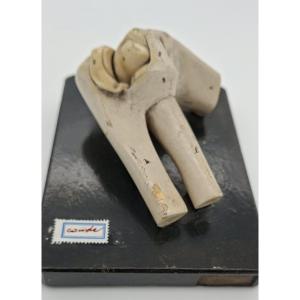 Anatomy Of The Elbow Joint