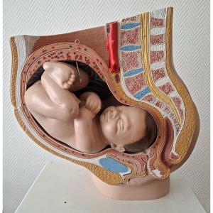 3d Obstetrical Baby