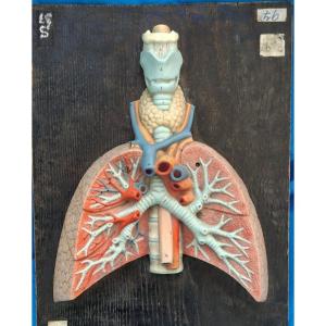 Latex Lung Section, Early 20th Century