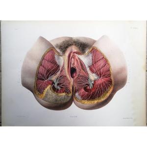 Lithographie - Perinee De La Femme- Traite De L 'anatomie De l'Homme - Dr Bourgery - Nh Jacob -