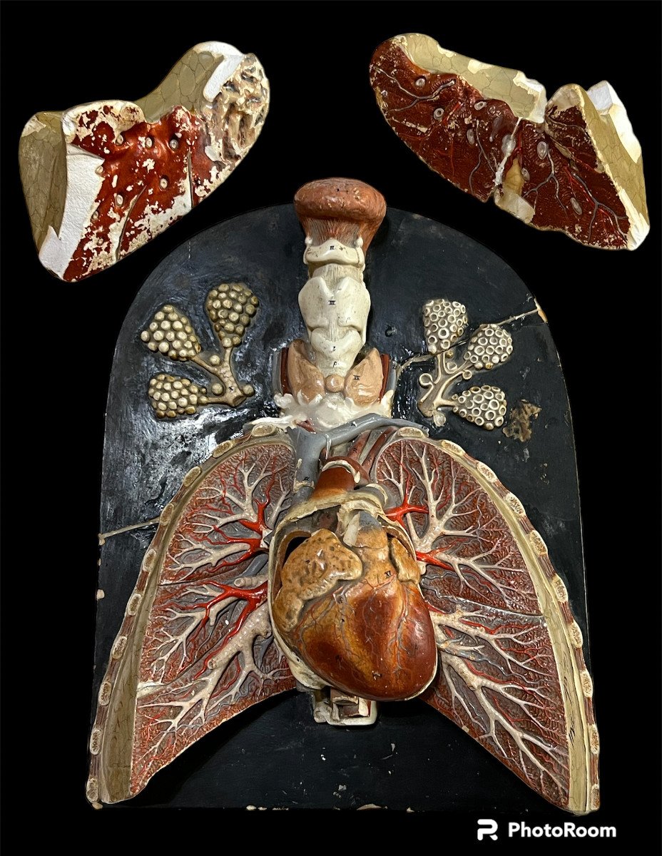 Bock Steger Lips modello anatomico fine de XIX sec.