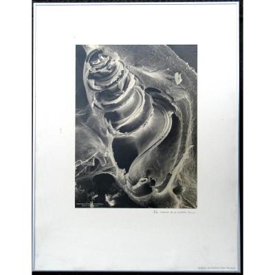 Scientific Photo 2: Internal View Of The Cochlee