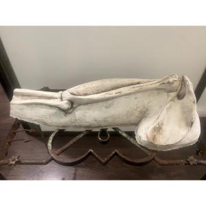 Plastered Arm Skinned